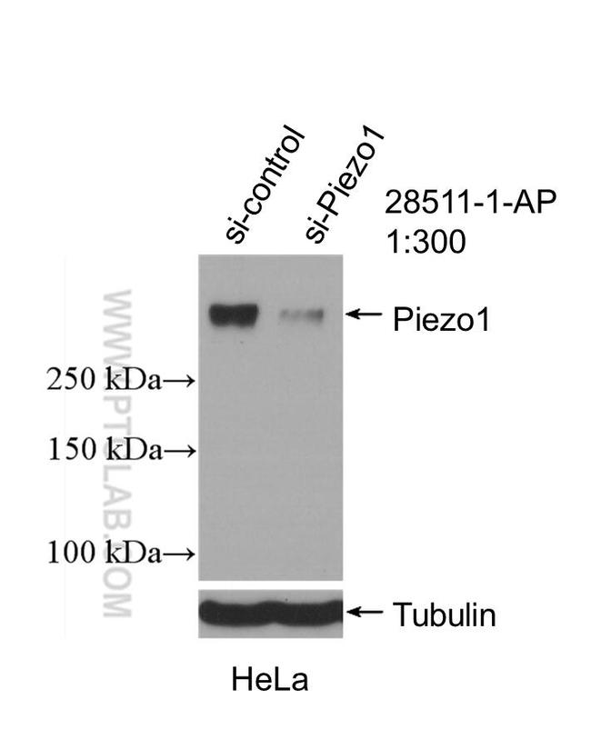 PIEZO1 (extracellular domain) Antibody in Western Blot (WB)