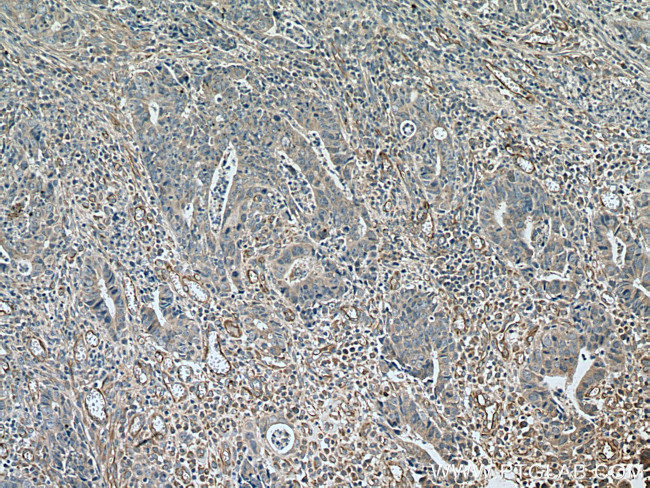 TYRO3 Antibody in Immunohistochemistry (Paraffin) (IHC (P))