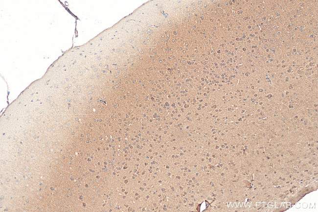 NMDAR2A/GRIN2A Antibody in Immunohistochemistry (Paraffin) (IHC (P))