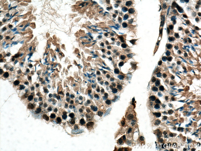 PRKDC Antibody in Immunohistochemistry (Paraffin) (IHC (P))