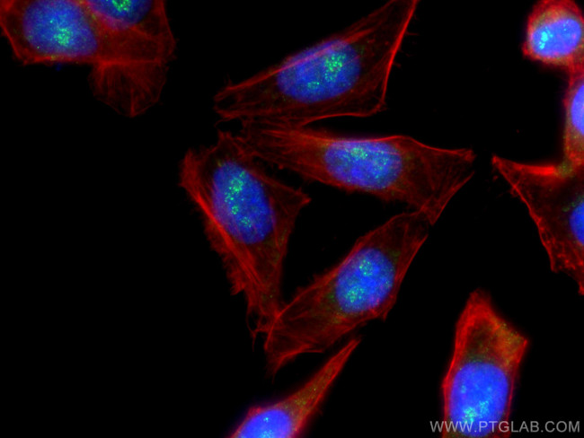 LEF1 Antibody in Immunocytochemistry (ICC/IF)