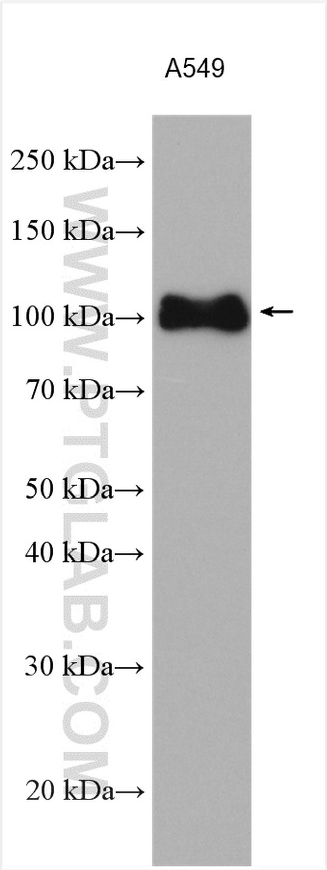 Integrin Beta 5 Antibody in Western Blot (WB)