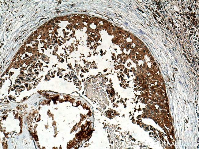 ABCE1 Antibody in Immunohistochemistry (Paraffin) (IHC (P))