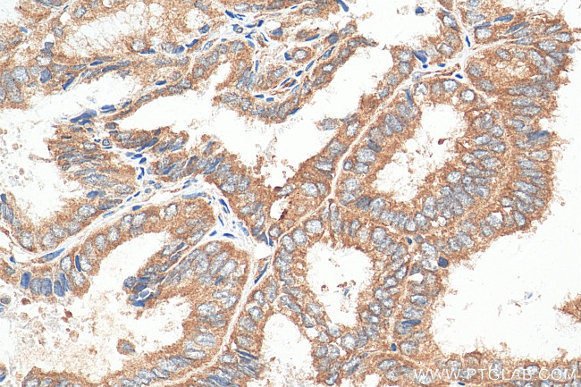 ABCE1 Antibody in Immunohistochemistry (Paraffin) (IHC (P))