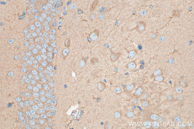 PICALM Antibody in Immunohistochemistry (Paraffin) (IHC (P))