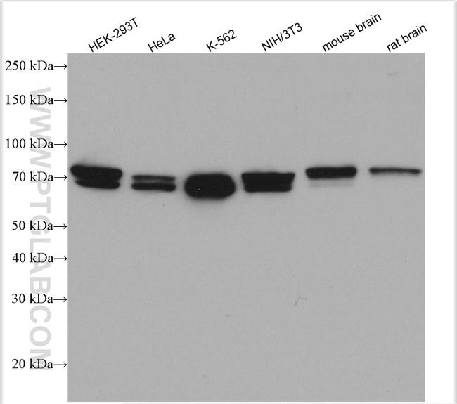 PICALM Antibody in Western Blot (WB)