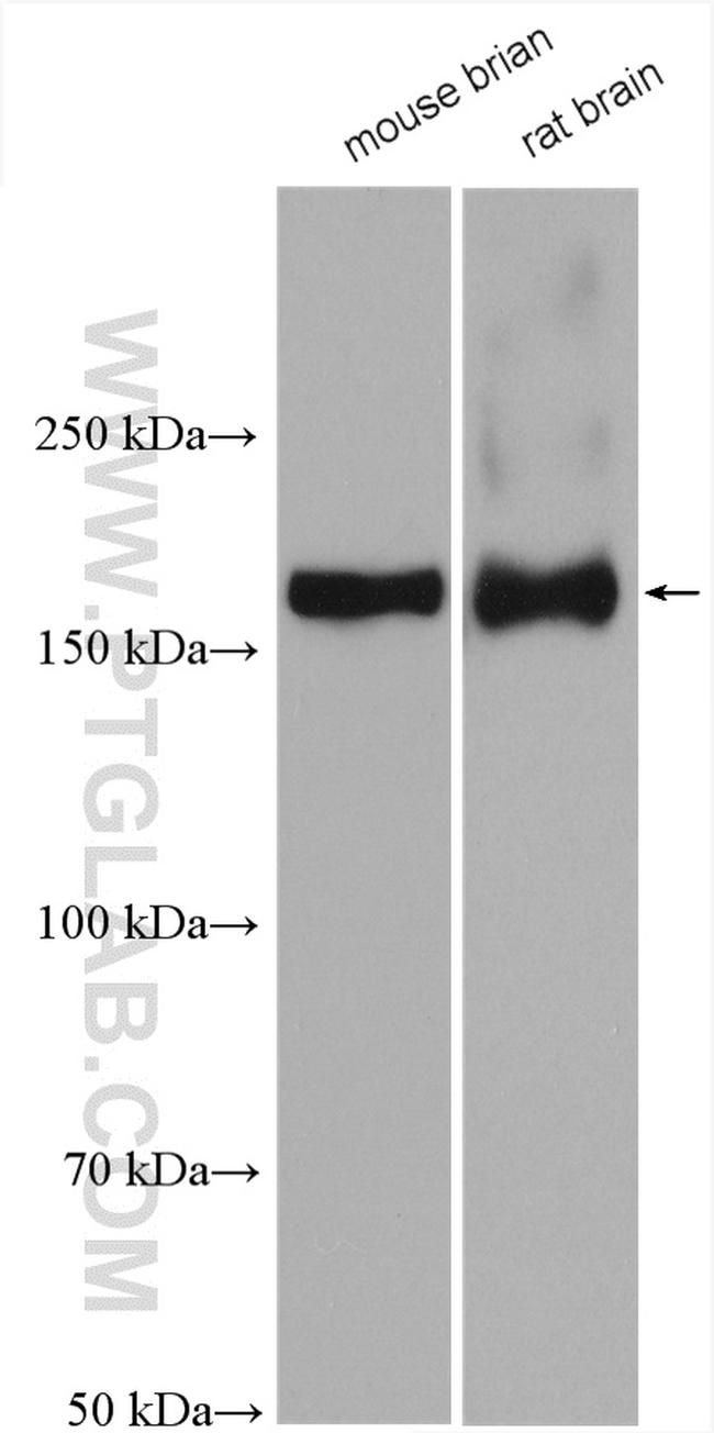 NMDAR2A/GRIN2A Antibody in Western Blot (WB)