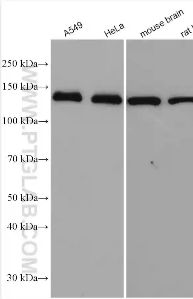 SUPT16H Antibody in Western Blot (WB)