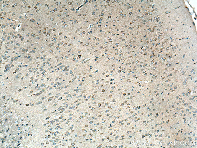 TAC1 Antibody in Immunohistochemistry (Paraffin) (IHC (P))