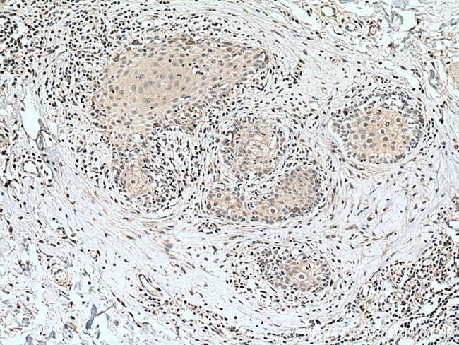 Cyclin B1 Antibody in Immunohistochemistry (Paraffin) (IHC (P))