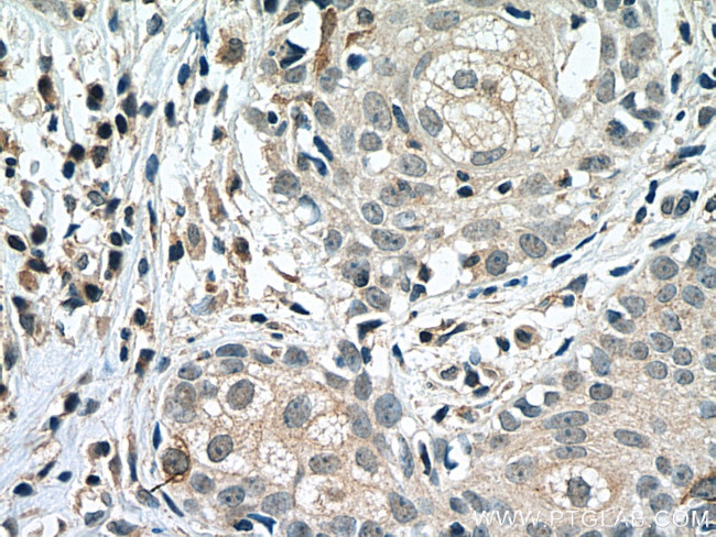 Cyclin B1 Antibody in Immunohistochemistry (Paraffin) (IHC (P))