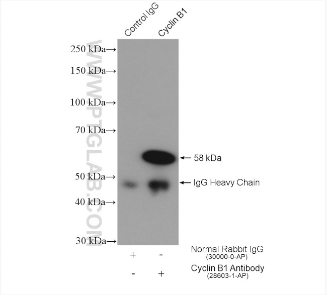 Cyclin B1 Antibody in Immunoprecipitation (IP)