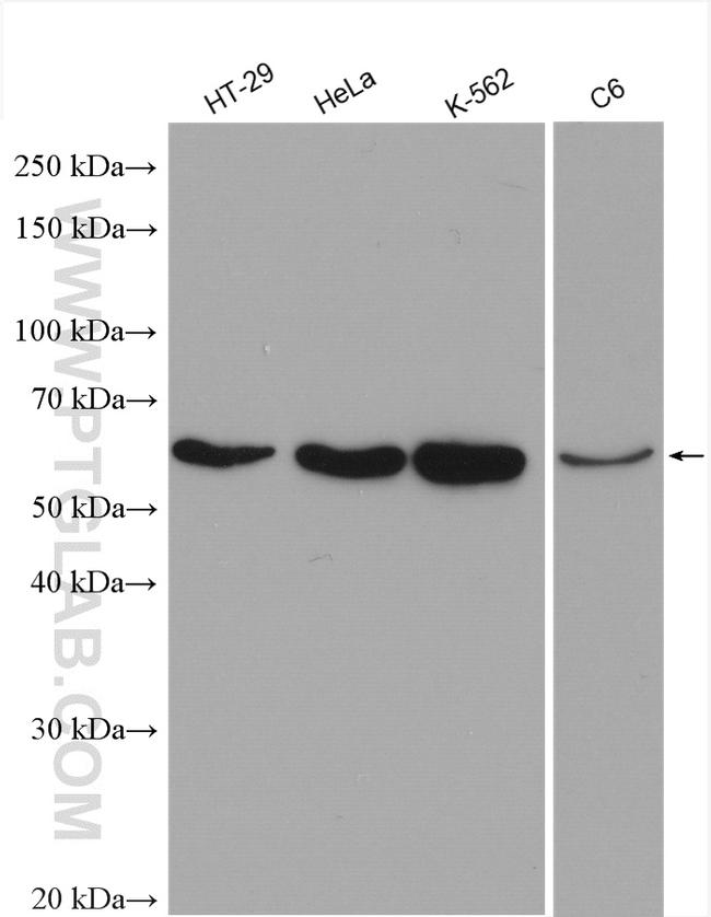 Cyclin B1 Antibody in Western Blot (WB)