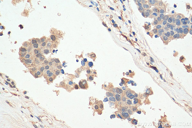 PPP1CA Antibody in Immunohistochemistry (Paraffin) (IHC (P))