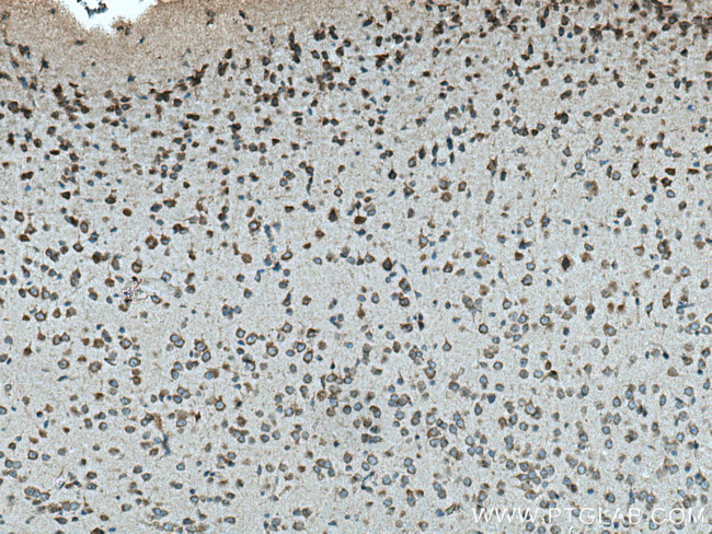 VPS13A Antibody in Immunohistochemistry (Paraffin) (IHC (P))