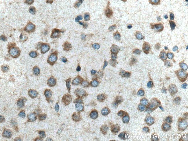 VPS13A Antibody in Immunohistochemistry (Paraffin) (IHC (P))