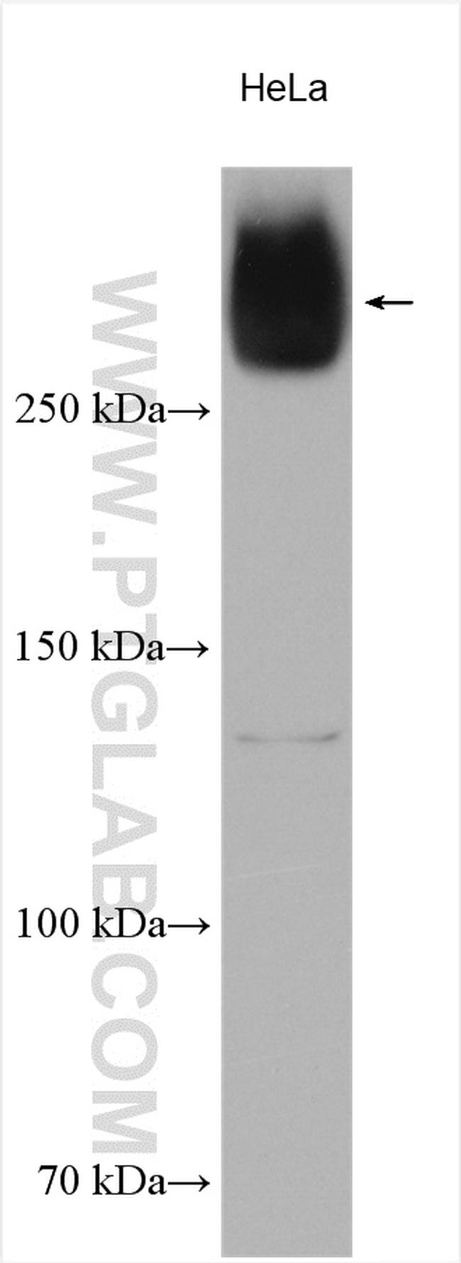 VPS13A Antibody in Western Blot (WB)