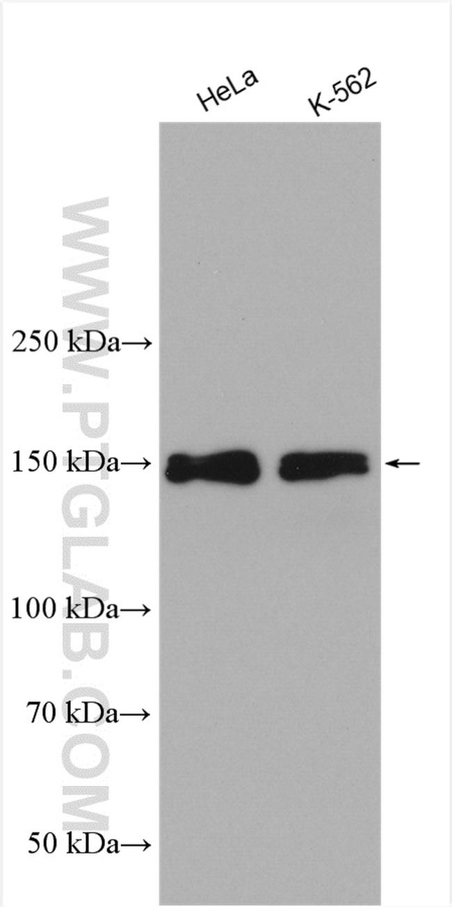 FANCD2 Antibody in Western Blot (WB)