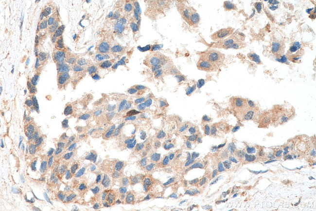 ATF4 Antibody in Immunohistochemistry (Paraffin) (IHC (P))