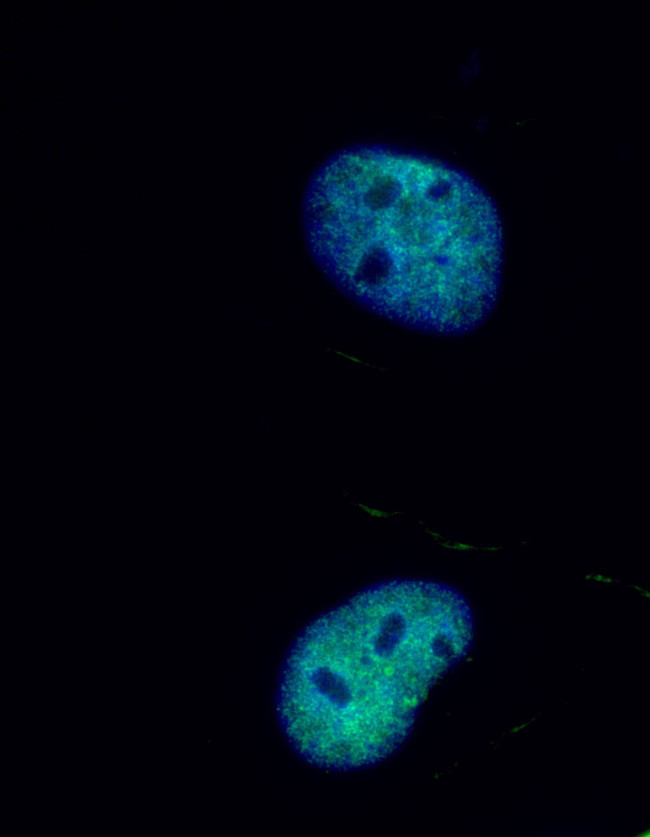 RFC5 Antibody in Immunocytochemistry (ICC/IF)