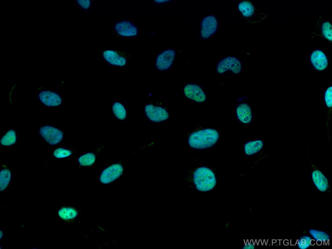 RFC5 Antibody in Immunocytochemistry (ICC/IF)