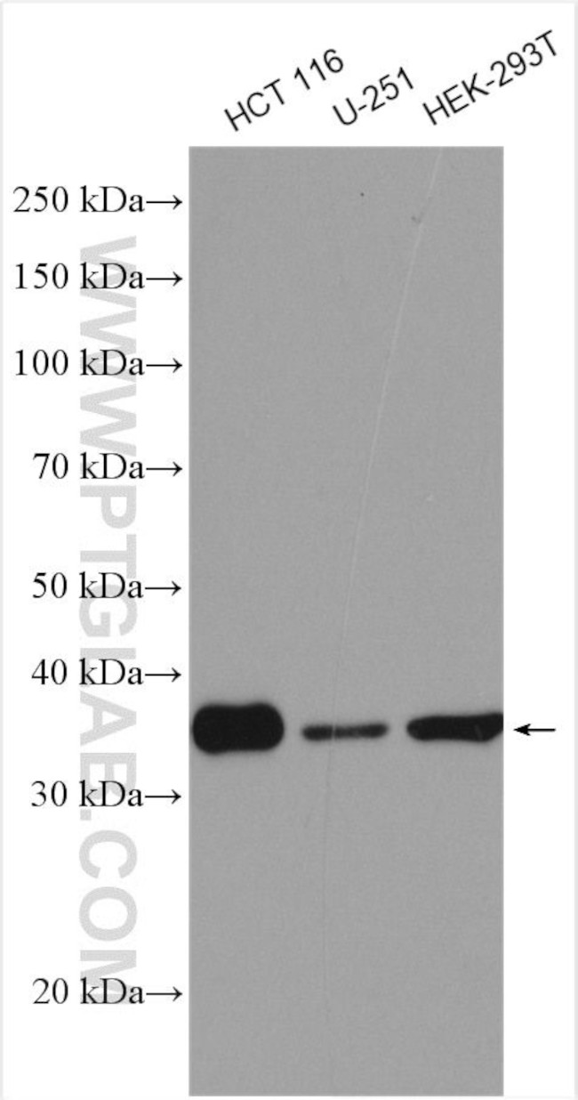 RFC5 Antibody in Western Blot (WB)