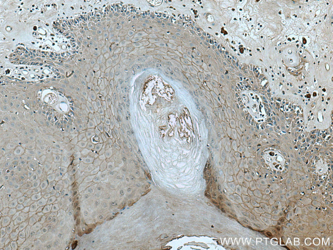 Claudin 1 Antibody in Immunohistochemistry (Paraffin) (IHC (P))