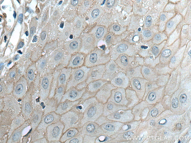 Claudin 1 Antibody in Immunohistochemistry (Paraffin) (IHC (P))