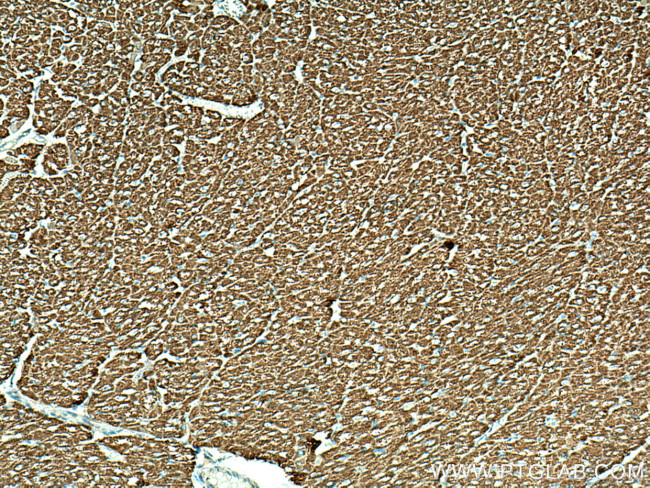 Sam50 Antibody in Immunohistochemistry (Paraffin) (IHC (P))