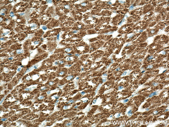 Sam50 Antibody in Immunohistochemistry (Paraffin) (IHC (P))