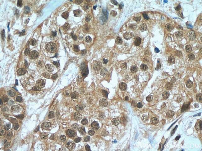 HORMAD1 Antibody in Immunohistochemistry (Paraffin) (IHC (P))