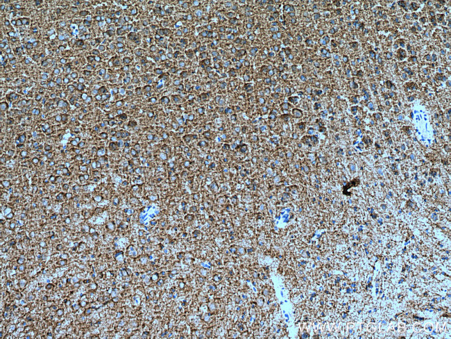 KCC2/SLC12A5 Antibody in Immunohistochemistry (Paraffin) (IHC (P))