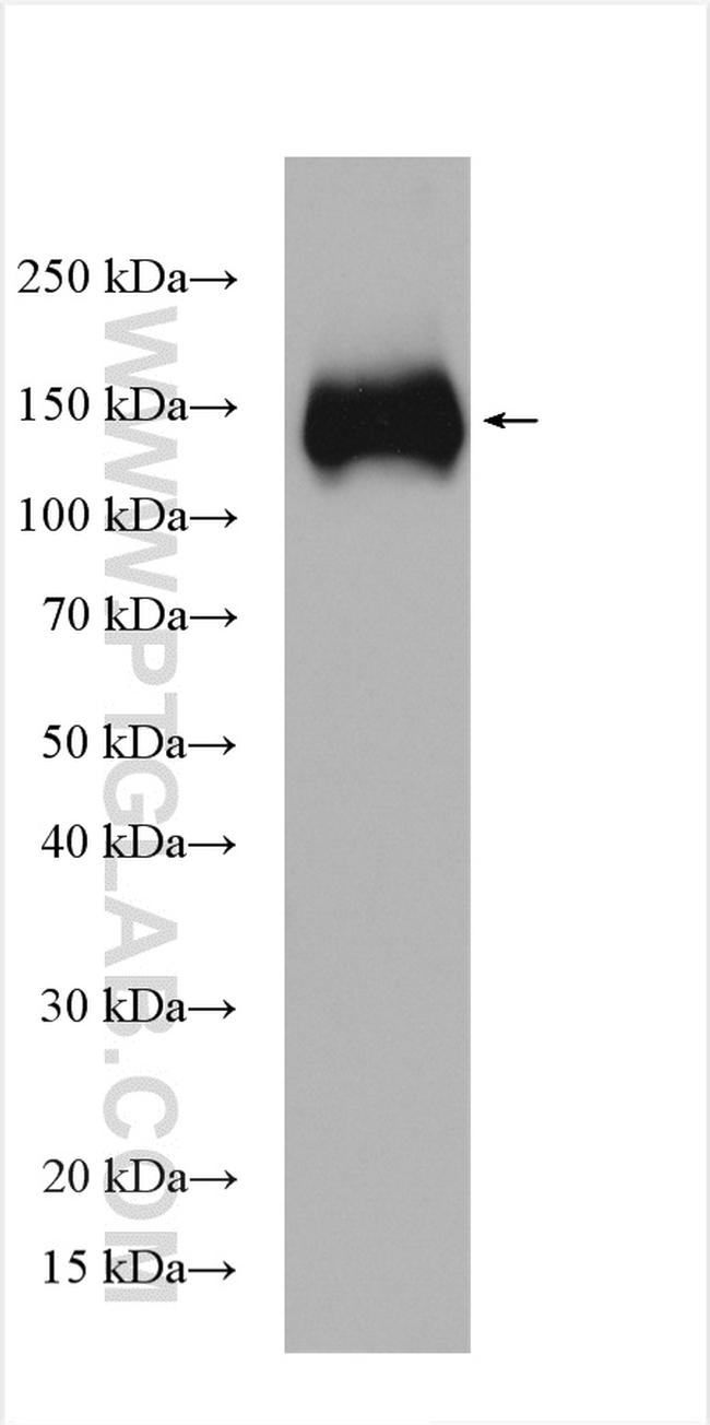 KCC2/SLC12A5 Antibody in Western Blot (WB)