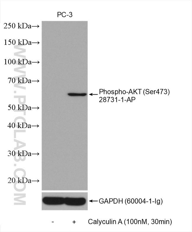 Phospho-AKT (Ser473) Antibody in Western Blot (WB)