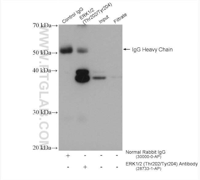 Phospho-ERK1/2 (Thr202, Tyr204) Antibody in Immunoprecipitation (IP)