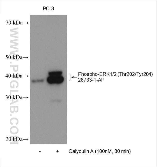 Phospho-ERK1/2 (Thr202, Tyr204) Antibody in Western Blot (WB)