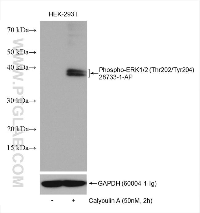 Phospho-ERK1/2 (Thr202, Tyr204) Antibody in Western Blot (WB)