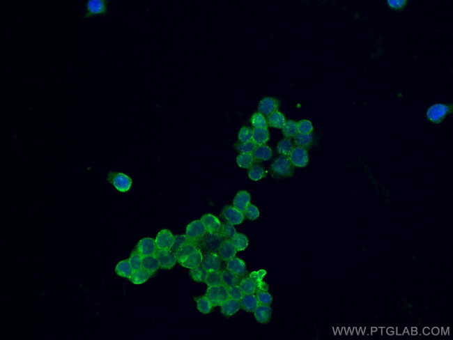 TNFR2 Antibody in Immunocytochemistry (ICC/IF)