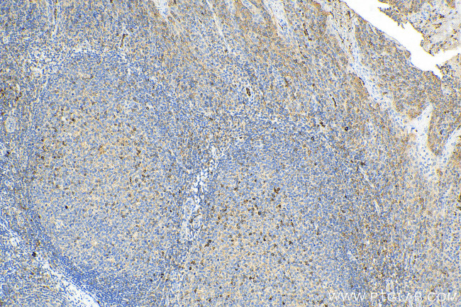 TNFR2 Antibody in Immunohistochemistry (Paraffin) (IHC (P))