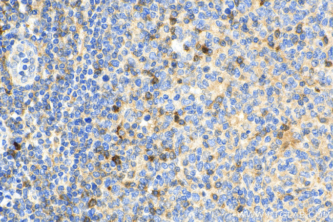 TNFR2 Antibody in Immunohistochemistry (Paraffin) (IHC (P))