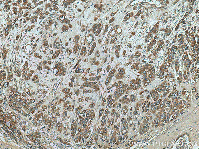 TRIM27 Antibody in Immunohistochemistry (Paraffin) (IHC (P))