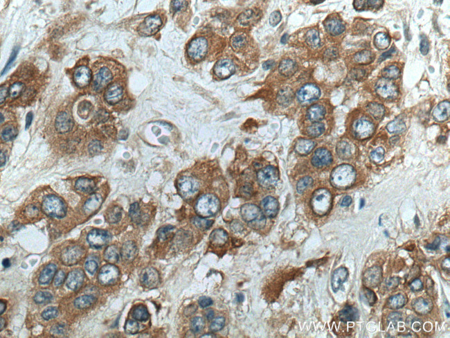 TRIM27 Antibody in Immunohistochemistry (Paraffin) (IHC (P))