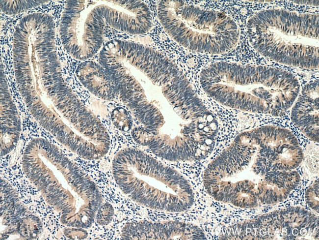 ZAK Antibody in Immunohistochemistry (Paraffin) (IHC (P))