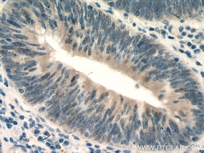 ZAK Antibody in Immunohistochemistry (Paraffin) (IHC (P))