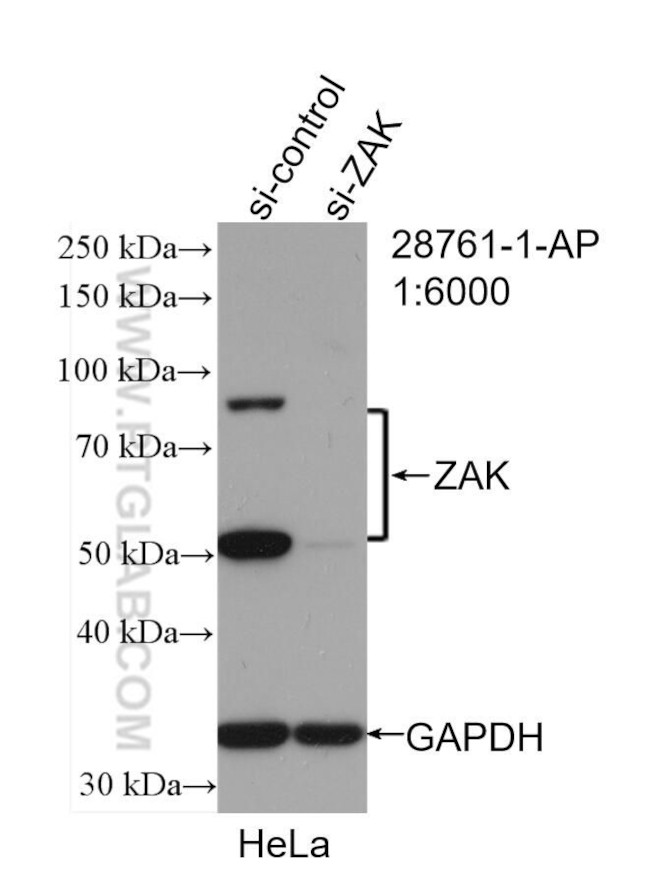 ZAK Antibody in Western Blot (WB)