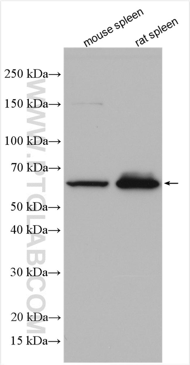 IRAK3 Antibody in Western Blot (WB)