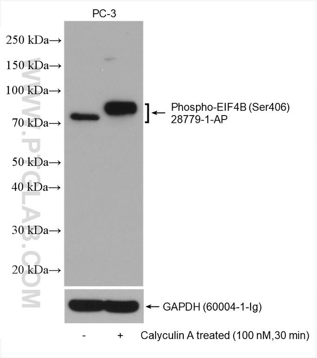 Phospho-eIF4B (Ser406) Antibody in Western Blot (WB)