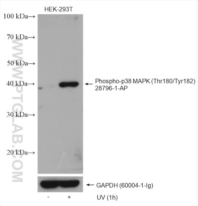 Phospho-p38 MAPK (Thr180, Tyr182) Antibody in Western Blot (WB)