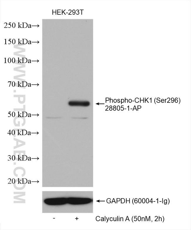 Phospho-Chk1 (Ser296) Antibody in Western Blot (WB)