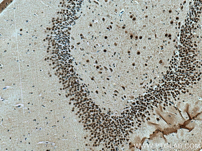 MEF2A Antibody in Immunohistochemistry (Paraffin) (IHC (P))